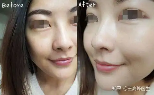 宝贝你就是个熊猫眼黑眼圈真是没睡好吗
