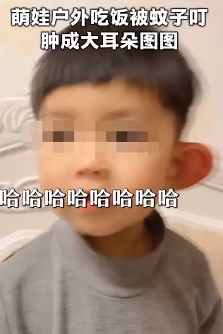 心疼又好笑男孩被蚊子叮成大耳朵图图,肿得都发亮了
