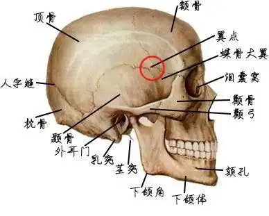 颅盖骨骨折
