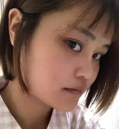 鼻综合拆线后,做任何面部表情都毫无压力