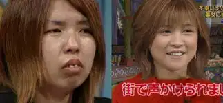 日本众多丑女因没钱整形纷纷下海当av女优
