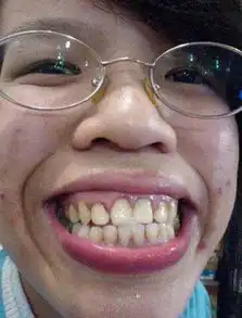 世界上最丑的老婆排行榜,猜猜都有谁
