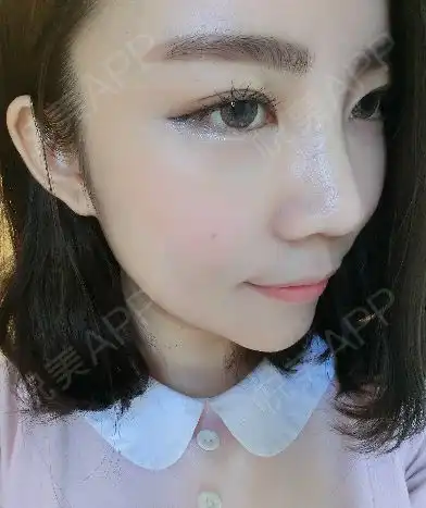 哈哈,最近真的是非常的迷上这种表情,感觉简单明...鼻综合悦美整形