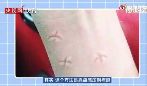 蚊子为什么爱叮你原因真没想到
