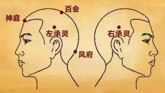 承灵穴头痛眩晕目痛
