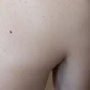 身上突然出现的小红点是什么最后一种是肝脏在报警
