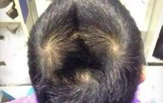 双旋男孩找不到,双旋女孩没人要,孩子头上的旋有啥含义
