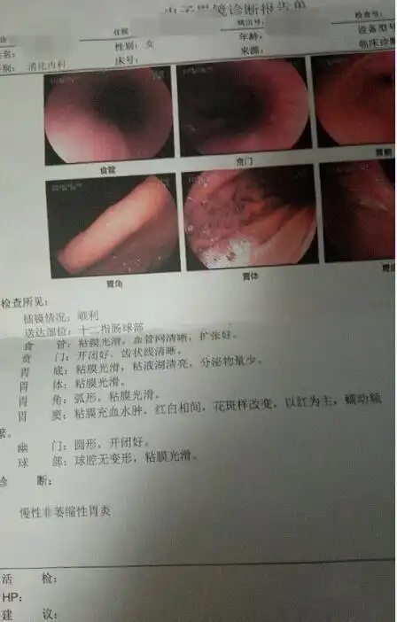 根除幽门螺杆菌可以减少人群37的胃癌发生这个数据是真实的策略
