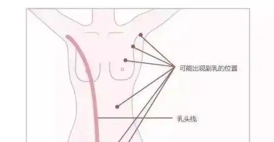你长副乳了吗副乳有真有假,你真的搞清副乳和赘肉的区别吗
