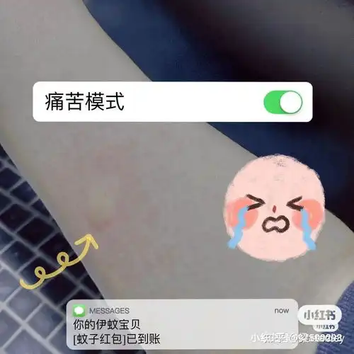 大家有被蚊子叮包后的奇葩照片吗
