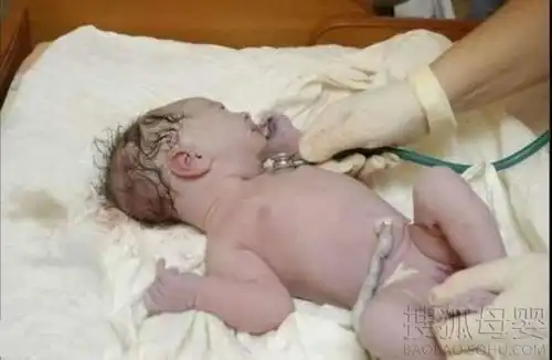 实拍孕妇顺产惊心全过程
